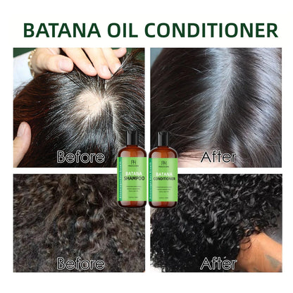 250ML Private Label High Quality Batana oil conditioner Anti Hair Loss Shampoo Growth Profissional Care Thinning Hair Shampoo