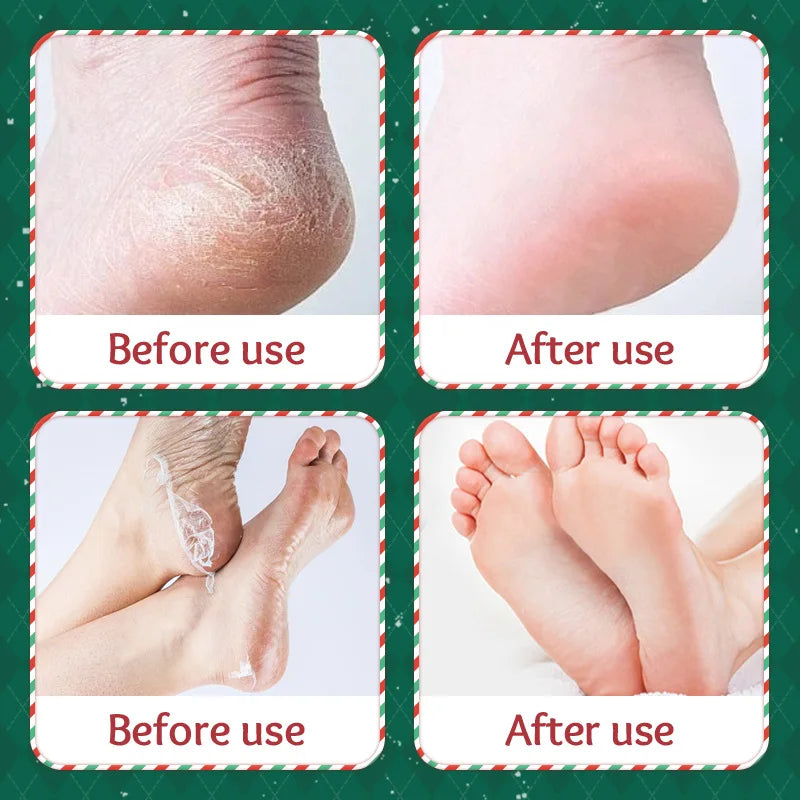 5 Paris SADOER Christmas Exfoliating Foot Mask Feet Skincare Glove Nourishing Tender Smooth Moisturizing Foot Masks Skin Care